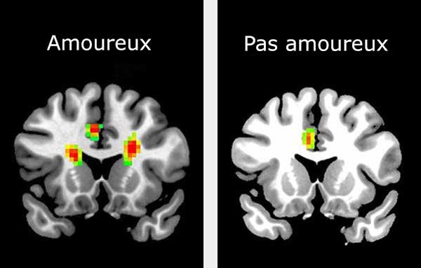 Gauche : scan d'un cerveau amoureux. Droite : scan d'un cerveau qui n'est pas amoureux.